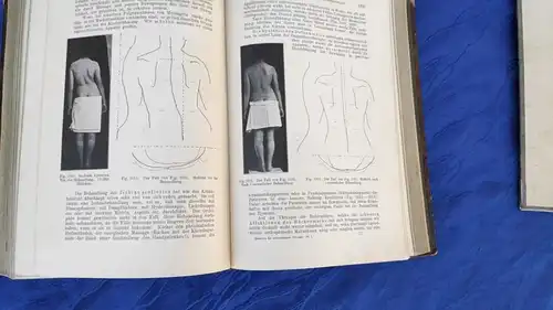 F765/ Handbuch der orthopädischen Chirurgie 1. Band 1905/07 Dr.Joachimsthal