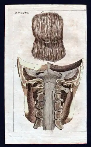 cervical vertebra Halswirbel Anatomie anatomy Medizin medicine Kupferstich