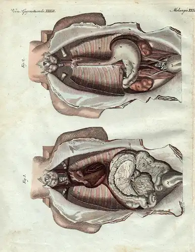 Verm. Gegenstaende XXXII / Melanges XXXII - Brusthöhle Bauchhöhle thoracic cavity chest cavity abdominal cavit