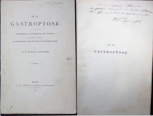 De la Gastroptose