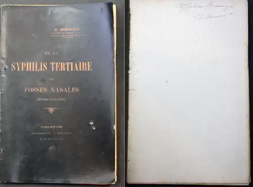 De la Syphilis Tertiaire des Fosses Nasales (Etude Clinique)