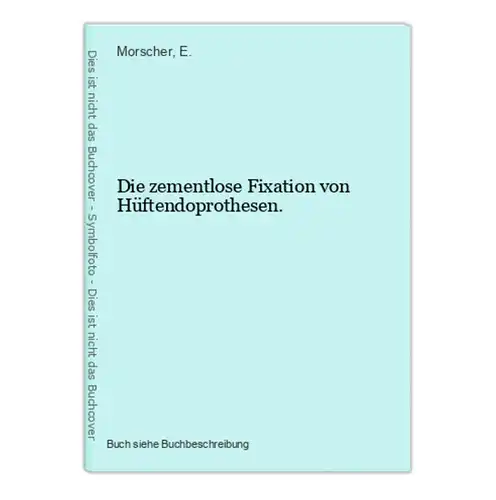 Die zementlose Fixation von Hüftendoprothesen.