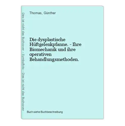 Die dysplastische Hüftgelenkpfanne. - Ihre Biomechanik und ihre operativen Behandlungsmethoden.