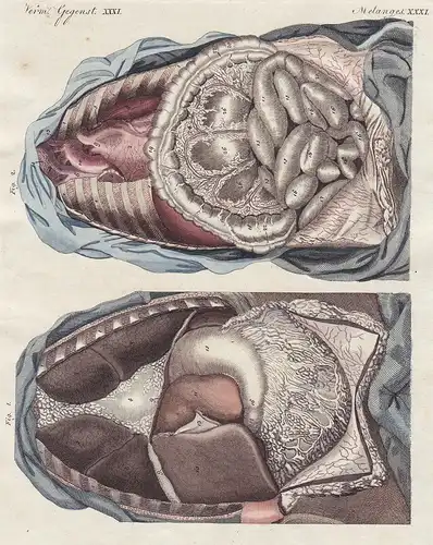 Verm. Gegenst. XXXI. - 1) Die Lage der Eingeweide, der Brust und des Unterleibes. - 2) Zweite Ansicht der geöf