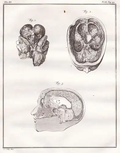 Kopf head Gehirn brain / Mensch person / anatomy Anatomie / Medizin medicine