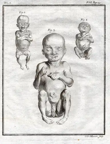 Pl. VI - Fetus Fötus / newborn baby / human anatomy Anatomie