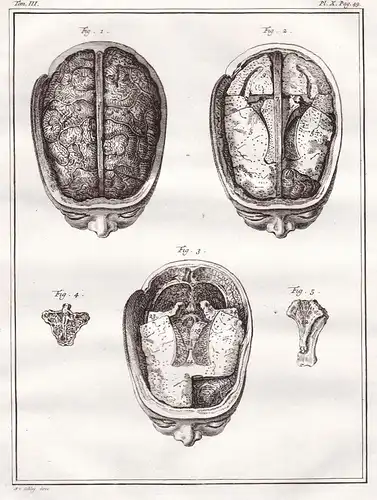 Kopf head Gehirn brain / Mensch  / human anatomy Anatomie / Medizin medicine