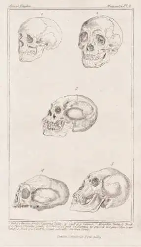 Skull of a Georgian female (Caucasian Variety).... - Skull Schädel Caucasian Mongolian / Anatomie human anato