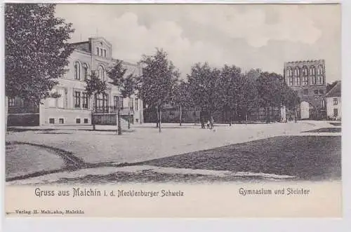 91148 Ak Gruß aus Malchin Gymnasium und Steintor um 1910