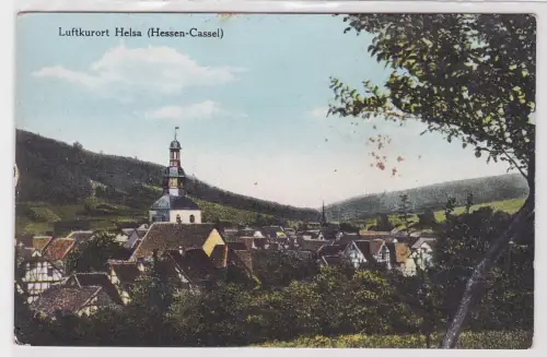 31028 Ak Luftkurort Helsa (Hessen-Cassel) um 1930