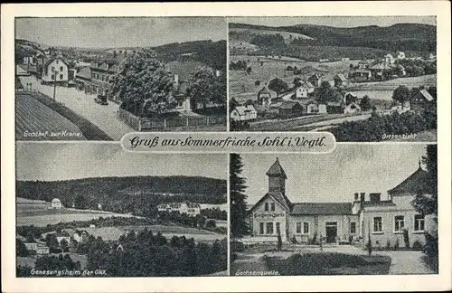 Ak Sohl Bad Elster im Vogtland, Gasthof zur Krone, Genesungsheim, Sachsenquelle