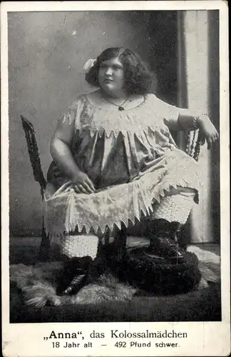 Ak Anna, das Kolossalmädchen, 18 Jahre alt, 492 Pfund schwer
