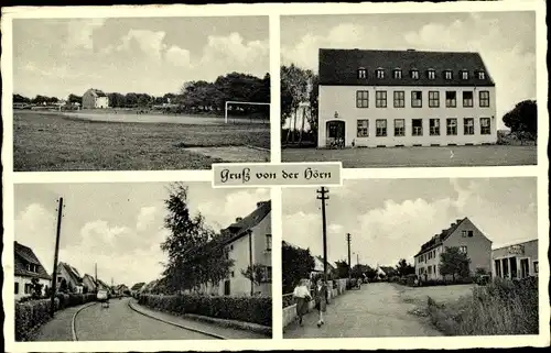 Ak Hörn Aachen in Nordrhein Westfalen, Kaufhaus Karl Driessen, Straßenpartie, Sportplatz