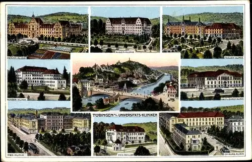 Ak Tübingen am Neckar, Universitäts Kliniken, Frauenklinik, Hautklinik, Kinderklinik, Nervenklinik