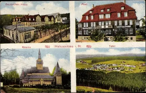 Ak Hahnenklee Bockswiese Goslar im Harz, Post, Gesamtansicht, Deutsches Haus, Kirche