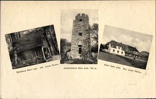 Ak Adenau in der Eifel, Blockhaus Hohe Acht, Aussichtsturm, Hotel Hohe Acht