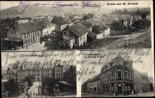 Ak St. Arnual Saarbrücken im Saarland, Gesamtansicht, Artilleriekaserne, Restauration
