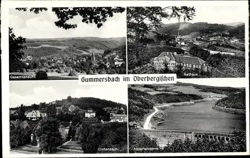 Ak Gummersbach im Oberbergischen Kreis, Gesamtansicht, Rathaus, Grotenbach, Aggertalsperre