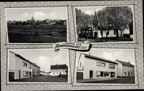 Ak Blankenheimerdorf Blankenheim an der Ahr Eifel, Ortspartien