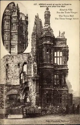 Ak Arras Pas de Calais, avant et aprés la Guerre, Hótel de Ville, Rue des Trois-Visages