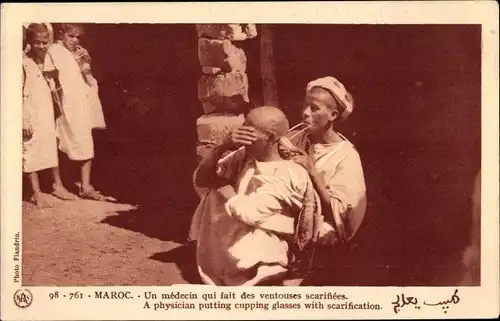 Ak Marokko, Maroc, Médecin, Ambulanter Arzt, Schröpfen, Ventouses scarifiées