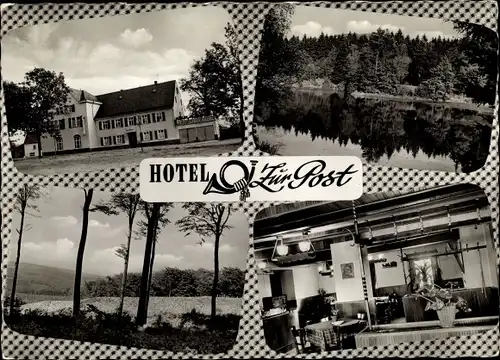 Ak Otzenhausen Nonnweiler an der Saar, Hotel Zur Post, See, Panorama