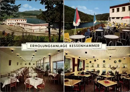 Ak Olpe im Sauerland Westfalen, Erholungsanlage Kessenhammer am Biggesee, Terrasse