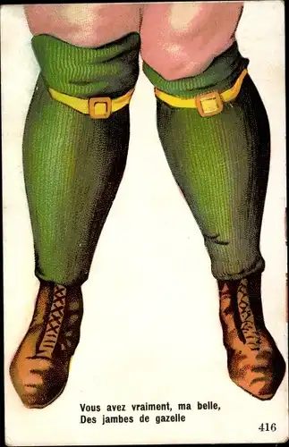 Ak Vous avez vraiment, ma belle, des jambes de gazelle, dicke Frauenbeine in Strümpfen