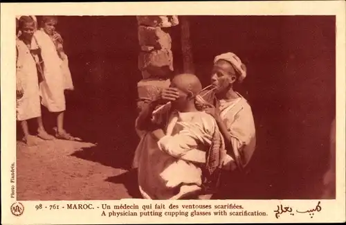 Ak Marokko, Maroc, Médecin, Ambulanter Arzt, Schröpfen, Ventouses scarifiées