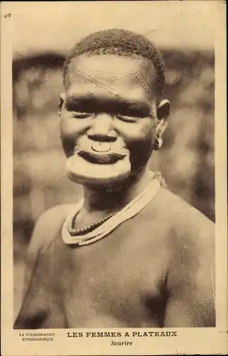 Ak Les Femmes à Plateaux, Sourire, Lippenteller, Schmucknarben