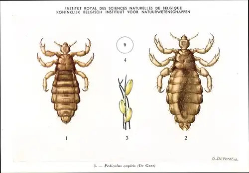 Künstler Ak Pediculus capitis, Kopflaus, Institut Royal des Sciences Naturelles de Belgique