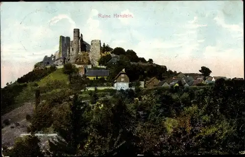Ak Rimbach Bornhagen im Eichsfeld, Burg Hanstein