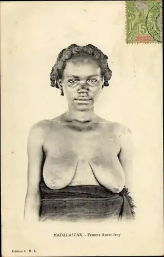 Ak Madagaskar, Frau mit großen Brüsten