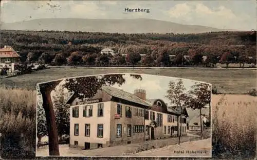 Ak Oberursel im Taunus Hessen, Hotel Hohemark, Herzberg