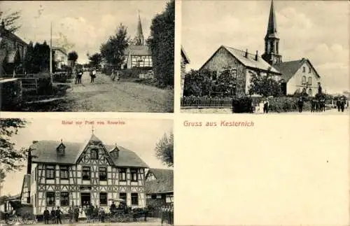 Ak Kesternich Simmerath in der Eifel, Hotel zur Post, Kirche, Straßenpartie