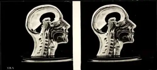 Stereo Foto Modell eines menschlichen Kopfes, Querschnitt, BIKA