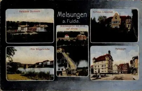 Ak Melsungen in Hessen, Heilstätte Stadtwald, Kurhaus Lindenlust, Alte Bürgerbrücke, Kirche