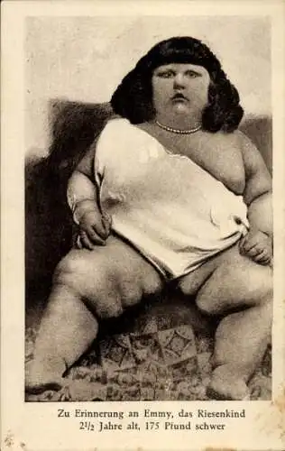 Ak Emmy, Riesenkind, 175 Pfund schwer