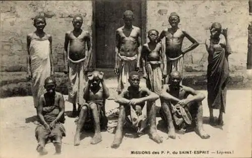 Ak Afrikanische Leprakranke