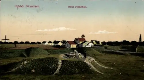 Ak Dänemark, Düppeler Schanzen, Hotel Düppelhöh