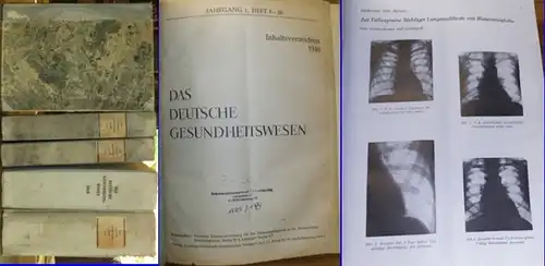 Deutsche Gesundheitswesen, Das. - / Deutsche Zentralverwaltung für das Gesundheitswesen in der Sowjetischen Besatzungszone / Ministerium für Gesundheitswesen Berlin (Hrsg.): Das Deutsche Gesundheitswesen - Zeitschrift...