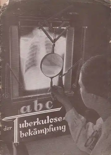 Klare, Kurt Prof. Dr. med: ABC der Tuberkoluse-Bekämpfung. Was muß der Laie von der Tuberkulose wissen?. 