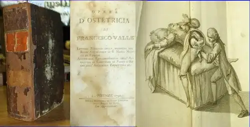 Valle, Francesco: Opera d'ostetricia. 3 vol. nelluno. 