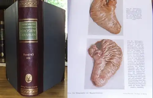 Fortschritte auf dem Gebiet der Röntgenstrahlung.   Heinrich Albers Schönberg (Begr.), Rudolf Grashey Köln (Hrsg.): Fortschritte auf dem Gebiet der Röntgenstrahlen.   43.. 