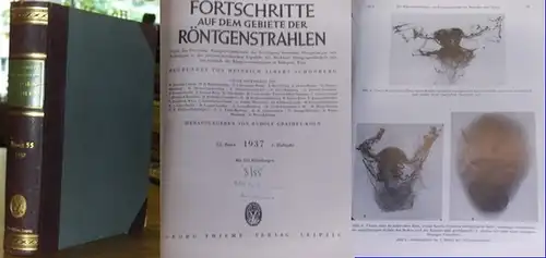 Fortschritte auf dem Gebiete der Röntgenstrahlung. - Heinrich Albers (Begr.), Rudolf Grashey (Hrsg.): Fortschritte auf dem Gebiete der Röntgenstrahlen. 55. Band 1937, 1. Halbjahr. Enthalten...