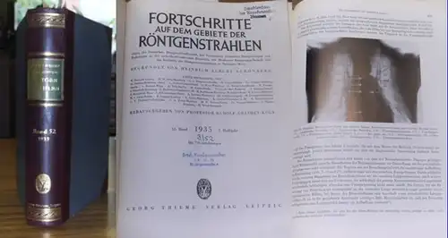 Fortschritte auf dem Gebiet der Röntgenstrahlung. - Heinrich Albers-Schönberg (Begr.), Rudolf Grashey-Köln (Hrsg.): Fortschritte auf dem Gebiet der Röntgenstrahlen. - 52. Band 1935 2. Halbjahr...
