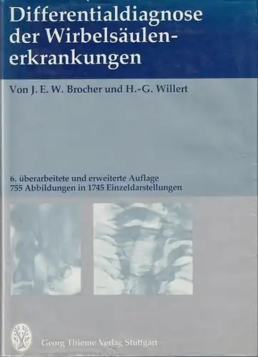 Brocher, J.E.W. - H.-G. Willert: Differntialdiagnose der Wirbelsäulenerkrankungen. Mit 755 Abbildungen und 1745 Einzeldarstellungen. 