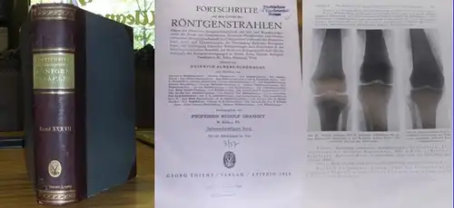 Fortschritte auf dem Gebiete der Röntgenstrahlen - Heinrich Albers-Schönberg (Begr.), Rudolf Grashey-Köln (Hrsg.): Fortschritte auf dem Gebiet der Röntgenstrahlen. - 37. Band 1928. Enthalten sind...