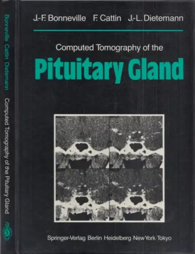 Bonneville, J.-F., F. Cattin, J.L. Dietemann: Computed Tomography of the Pituitary Gland. With a chapter on Magnetic Resonance Imaging of the Sellar and Juxtasellar Region. 