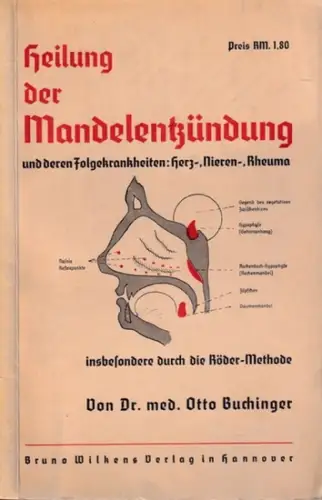 Buchinger, Otto: Heilung der Mandelentzündung und deren Folgekrankheiten: Herz-, Nieren-, Rheuma insbesondere durch die Röder-Methode. 